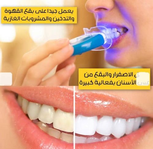 جهاز تبيض الأسنان وايت لايتLED
