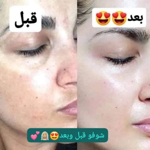 منتج تبيض فضيع
