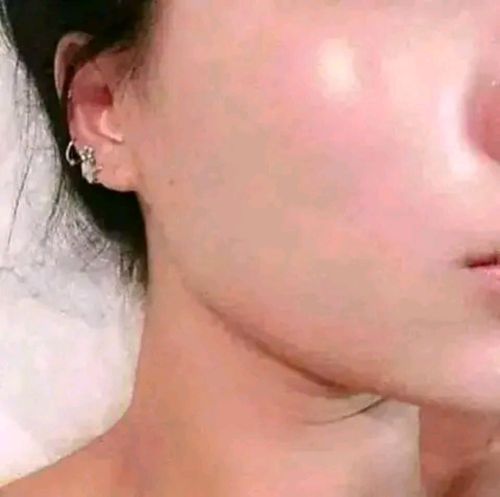 وداعاً لمشاكل البشرة
حل نهائي