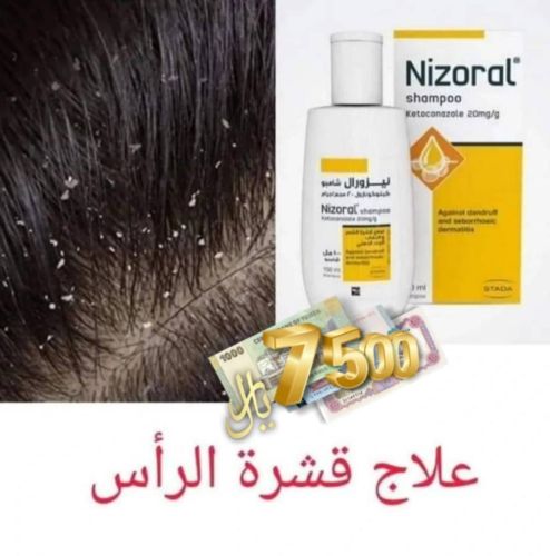 علاج قشرة الشعر وتساقط الشعراليمن