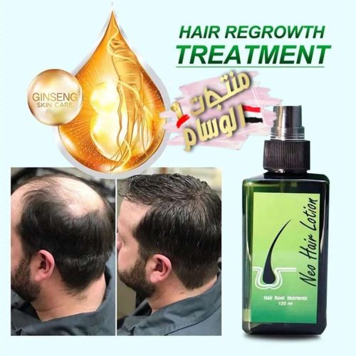 اروع علاج تكثيف الشعر وتنبيت