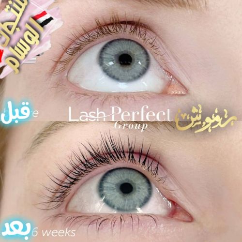 تطويل الرموش العين وتكثيف يجنن