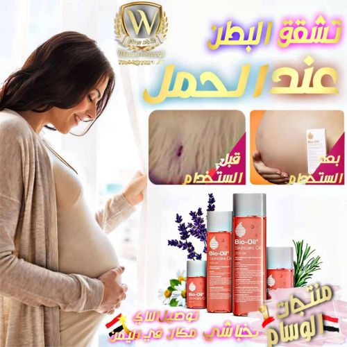 تشقق البطن بعد الحمل وتمدد الجلاد