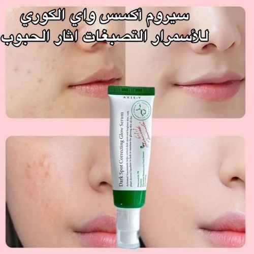 كريم ينهي الحبوب الي ب وجه مجرب