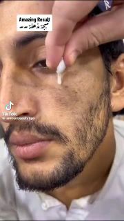 كبسولات تبييض للرجال والنساء