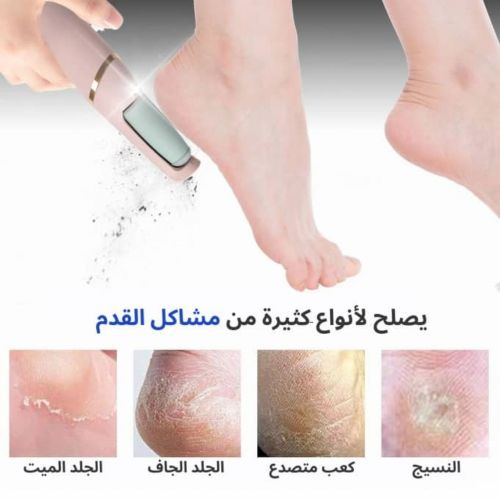 جهاز لازالة التشويش للقدم