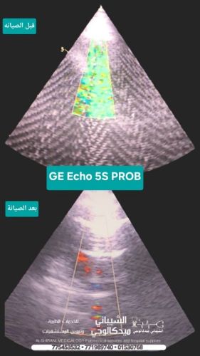 اصلح جميع انواع البروبات السونار