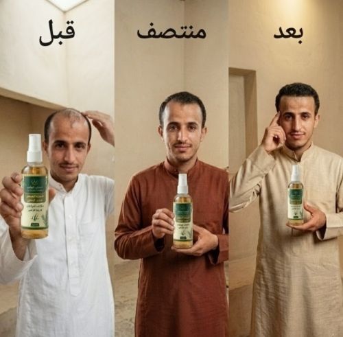 مستخلص عشبي مركز لنمو الشعر