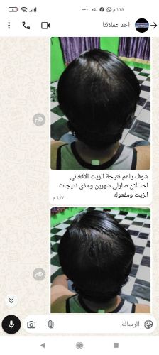 فستاتين اليمن صنعاء أب تعز ذمار