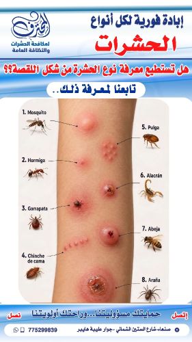 شاهد نوع اللدغة القبصة للحشرة